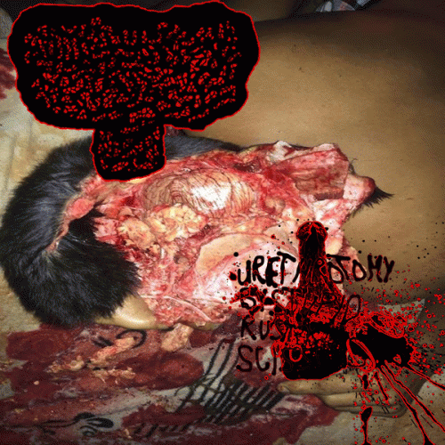 Carcinoma Basocelular : Carcinoma Basocelular - Urethrotomy by Stupid Rusty Scissors Carcinoma Basocelular : Carcinoma Basocelular - Urethrotomy by Stupid Rusty Scissors